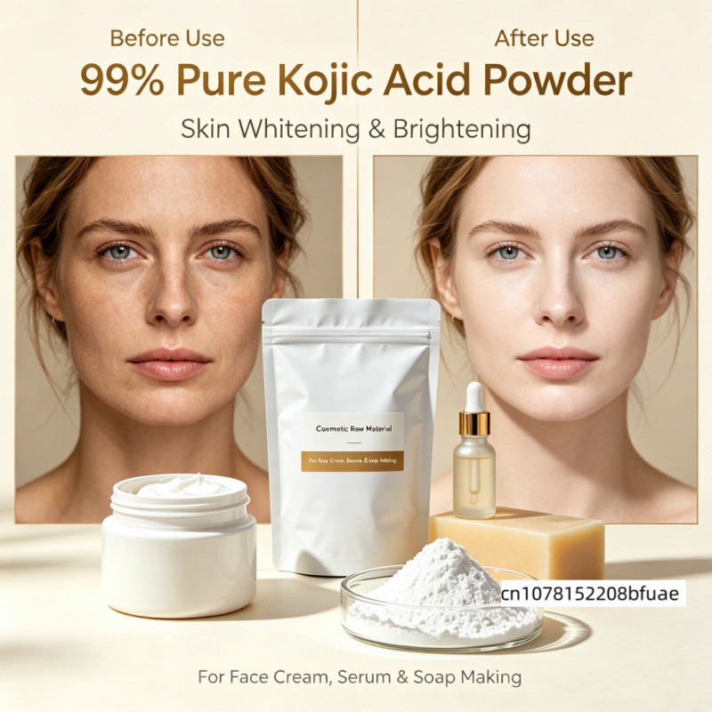 Soap Making Acid - ผงโคจิกแอซิดบริสุทธิ์ 99% วัตถุดิบเครื่องสำอางเพื่อผิวขาวกระจ่างใส สำหรับทำครีมบำรุงผิวหน้า เซรั่ม และสบู่